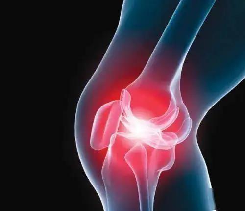 目前我国膝关节症状性骨关节炎发病率为8.1%，普遍认为病因主要与年龄、肥胖、炎症、损伤、以及遗传等因素相关。.jpg